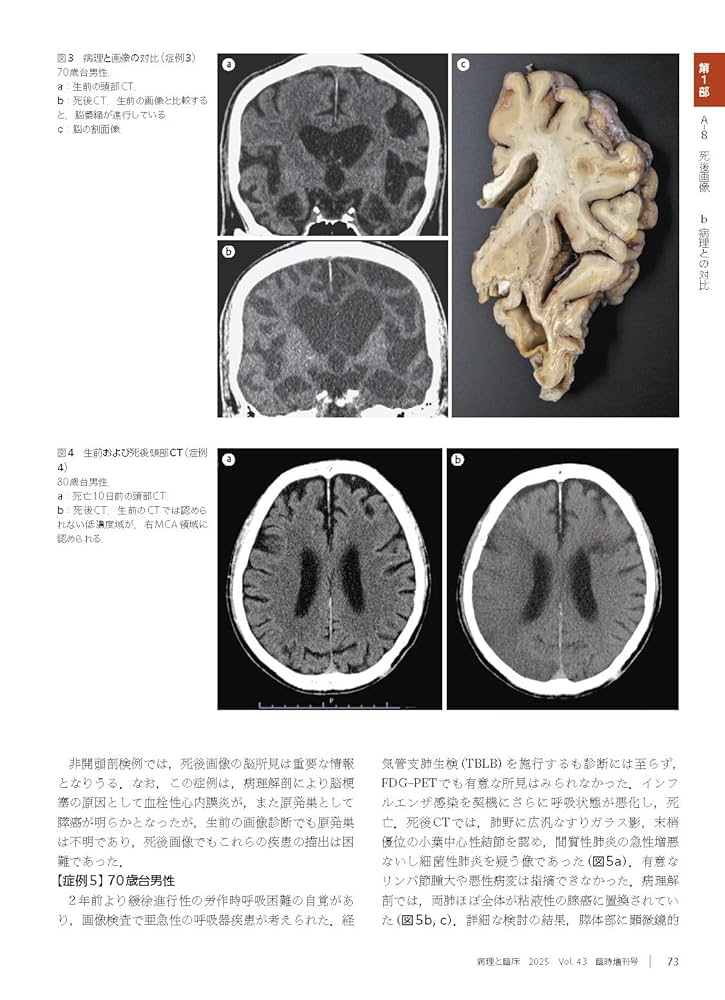 【裁断済】病理と臨床　2017年臨時増刊号（35巻） 病理診断に直結した組織学 病理と臨床 2017年臨時増刊号【電子版】 | 医書.jp